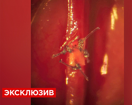 В Новосибирске завершились испытания "живого" протеза сосудов